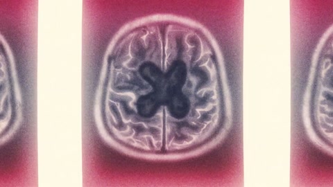 Sakamoto Days Parte 2 Episodio 4